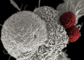 Cientistas caminham para 'turbinar' células de defesa contra o câncer