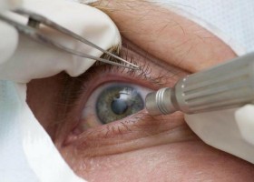 Consultas regulares ao médico podem afastar risco de glaucoma