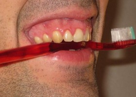 Manter a higiene da boca em dia pode ajudar na prevenção do...