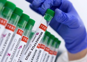 Primeiro infectado com varíola dos macacos recebe alta em SP